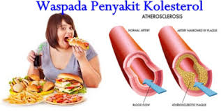 Illustration for article titled Obat Kolesterol Apotik